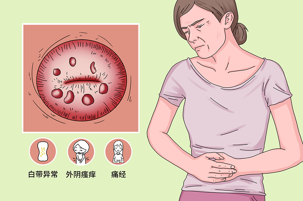 宫颈腺体囊肿图片大全图片